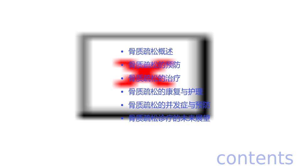 骨质疏松的诊疗通用课件_第2页