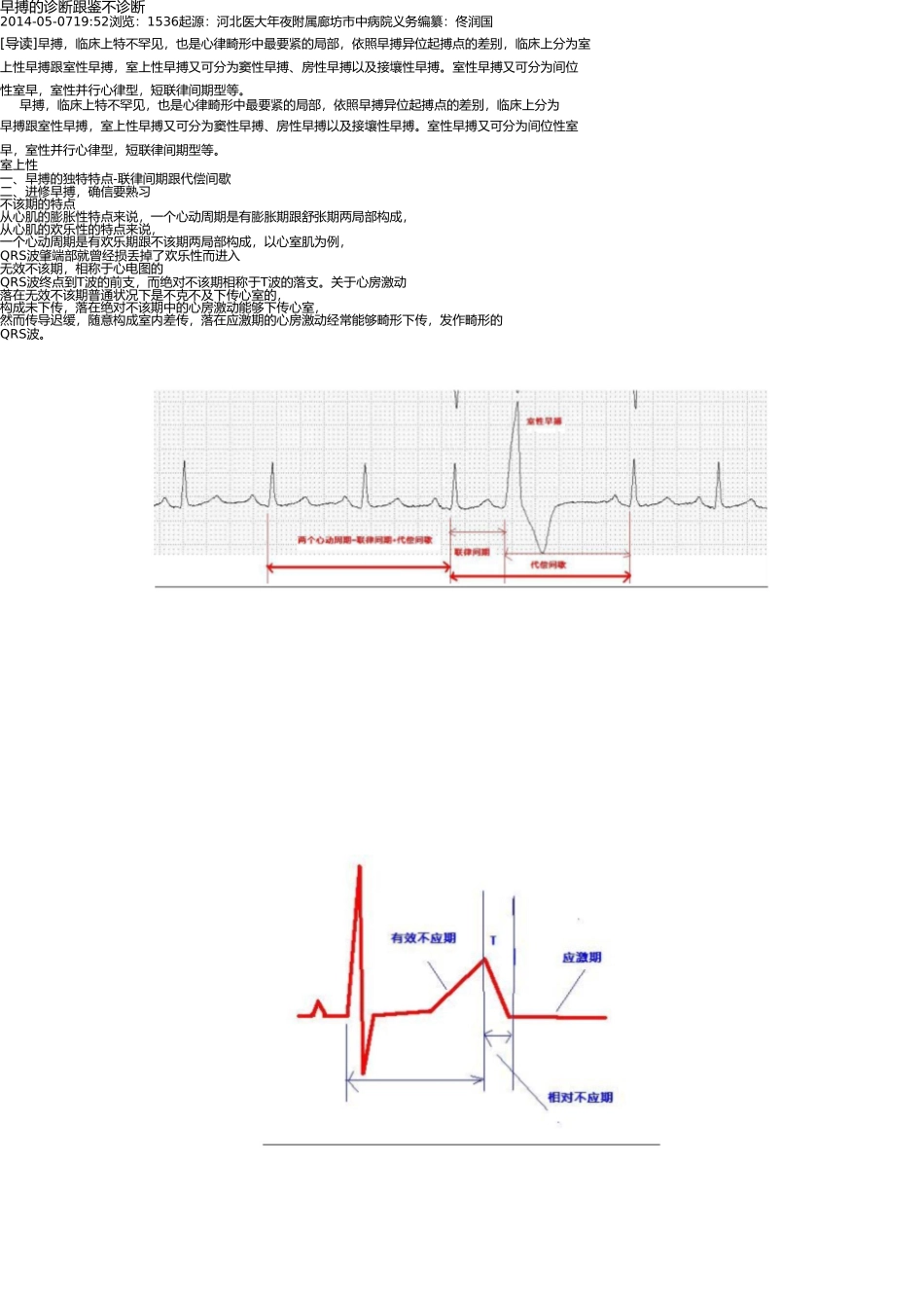 早搏的诊断和鉴别诊断 _第1页