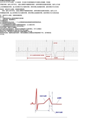 早搏的诊断和鉴别诊断 