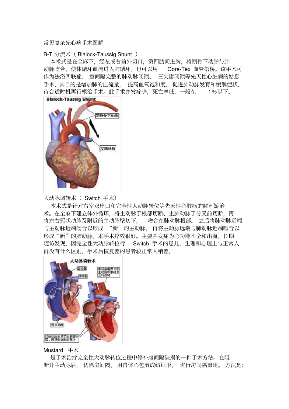常见复杂先心病手术图解_第1页