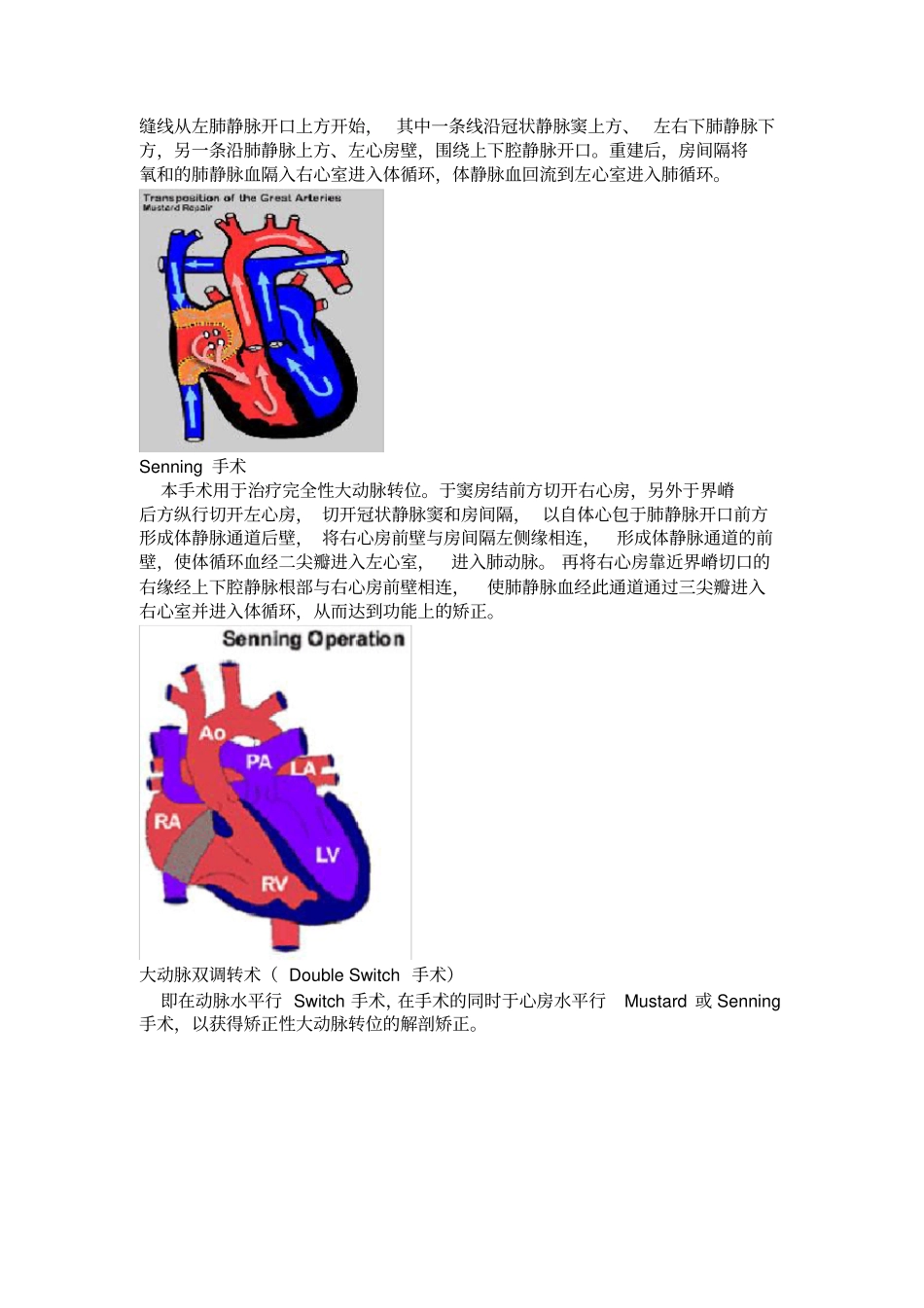 常见复杂先心病手术图解_第2页