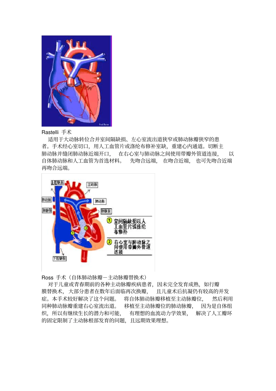 常见复杂先心病手术图解_第3页