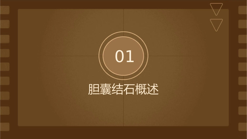 胆囊结石实习生课件_第3页