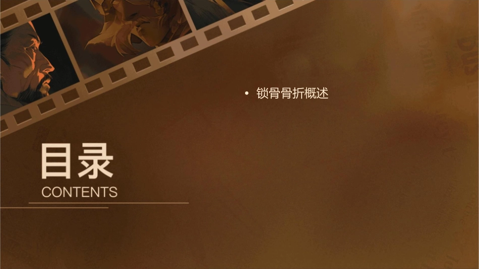 锁骨骨折的查房护理课件_第2页