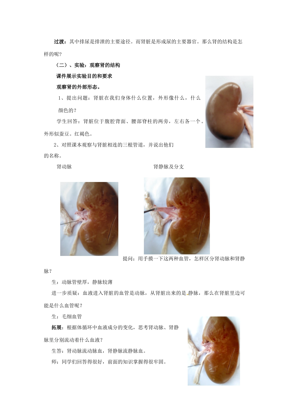 七年级生物下册 第3单元 第4章 第1节 尿液的形成和排出（第1课时）教案1 （新版）济南版_第3页