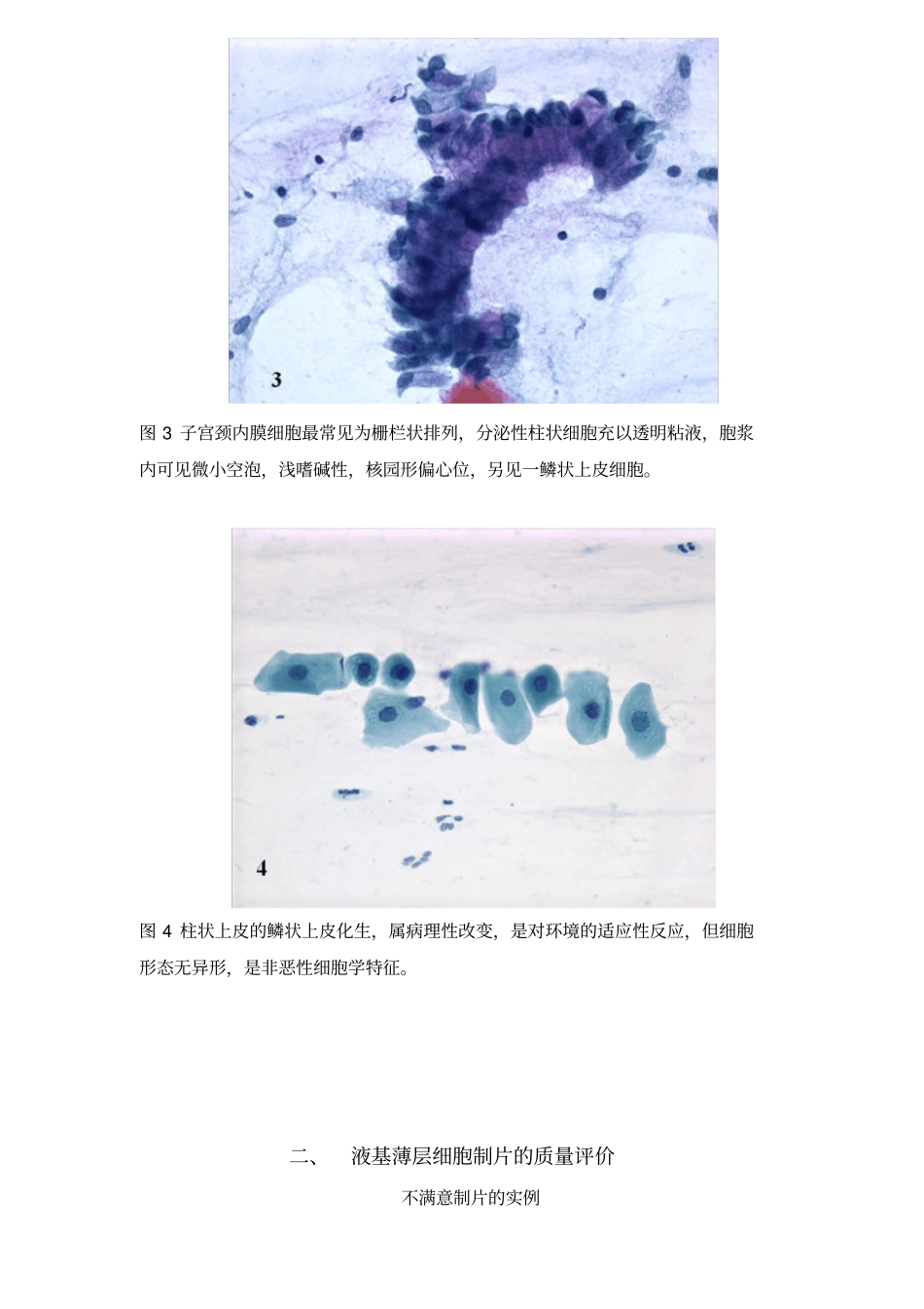 图谱宫颈细胞学_第2页