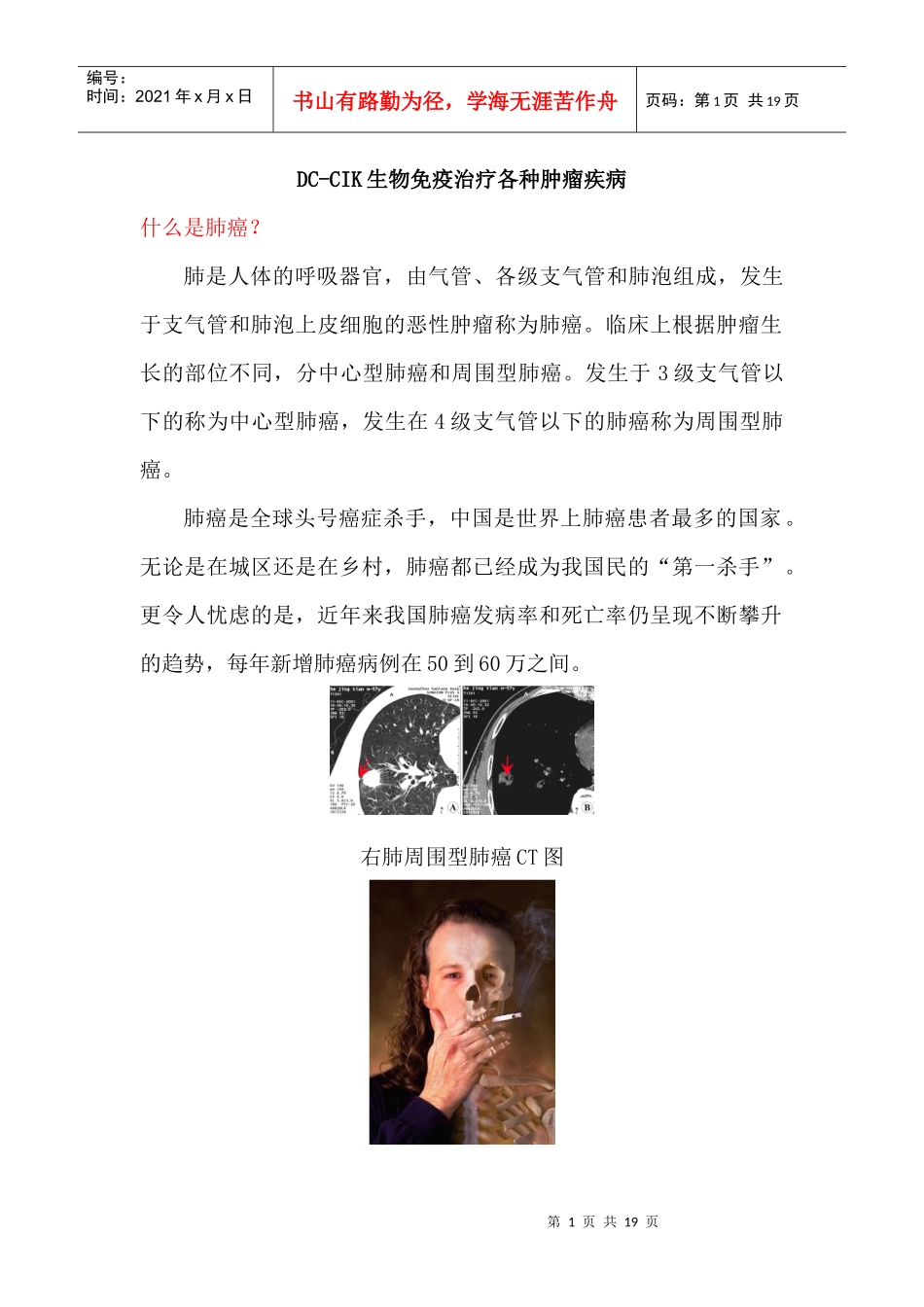 DC-CIK生物免疫治疗各种肿瘤疾病_第1页