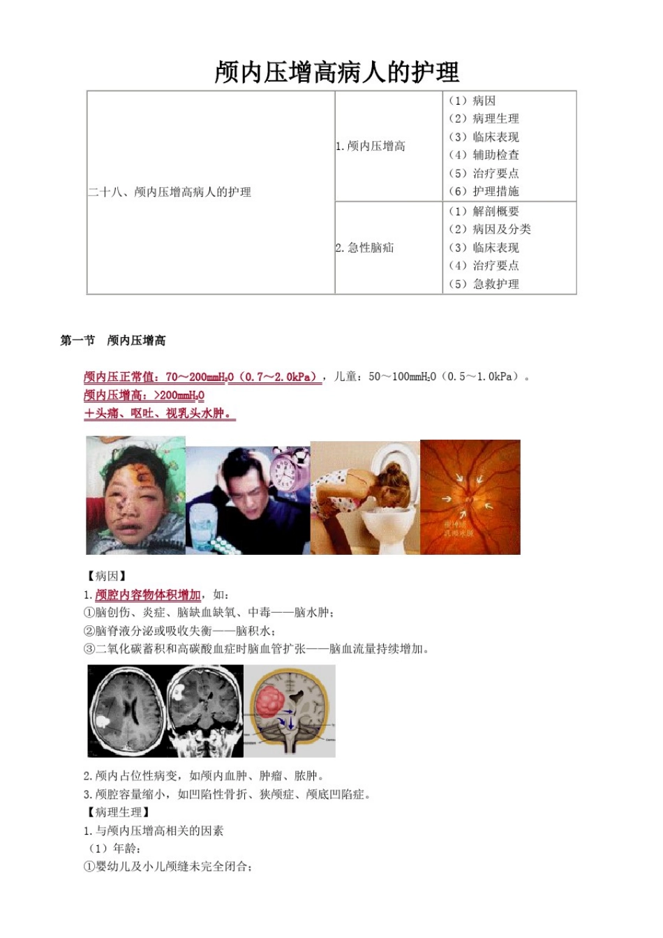 外科护理学图文讲义-颅内压增高病人的护理_第1页