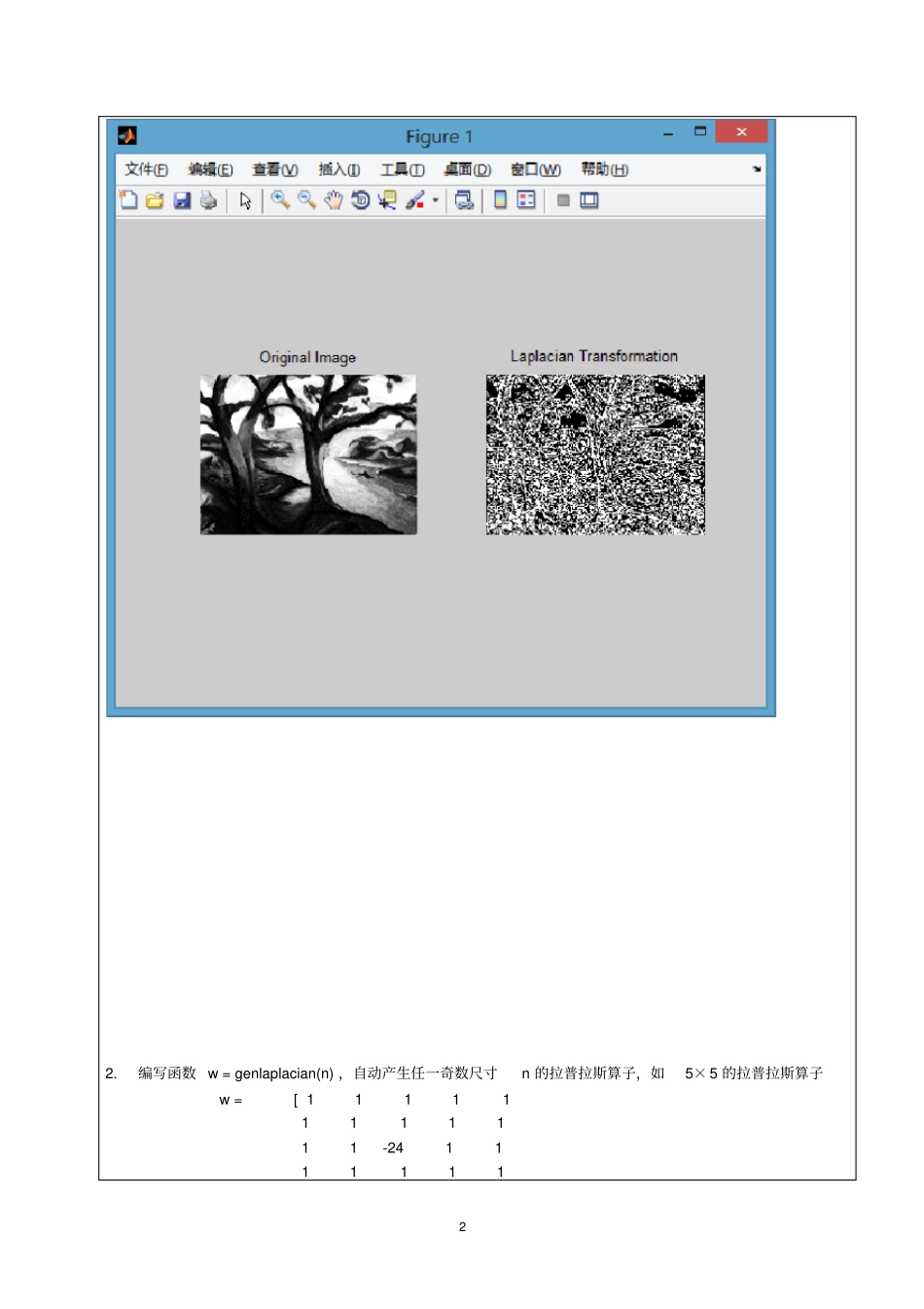 数字图像处理实验报告——图像增强实验_第3页