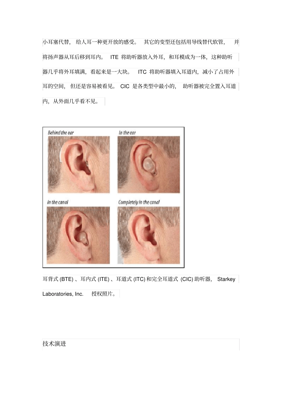 助听器的介绍和设计要点说明_第2页
