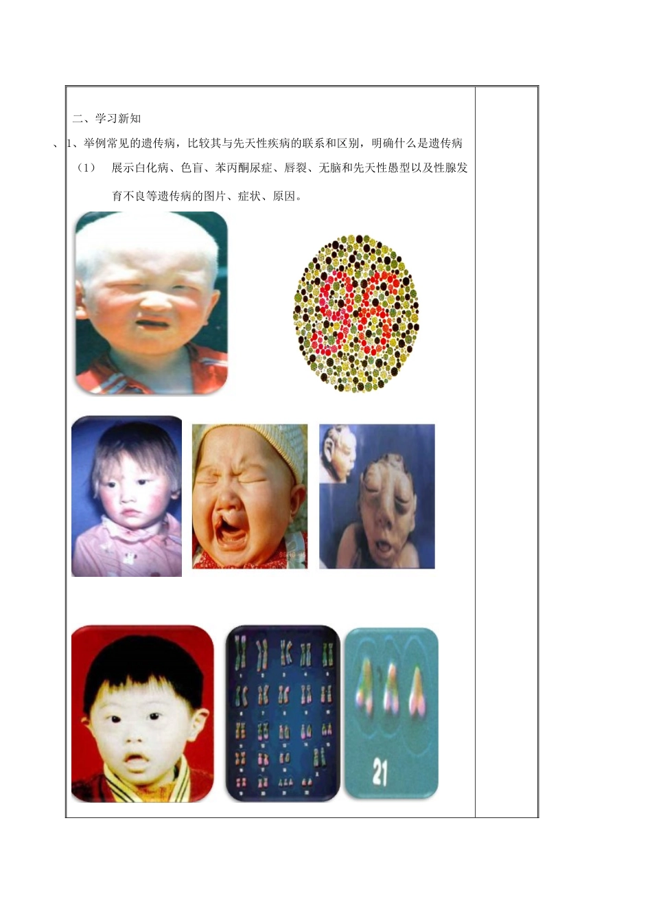 八年级生物下册 第八单元 生物的生殖、发育与遗传 第二十二章 生物的遗传和变异 第四节 遗传病和优生优育教案3（新版）苏教版-（新版）苏教版初中八年级下册生物教案_第2页