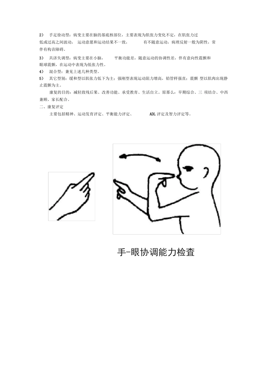脑瘫儿童康复指导手册_第2页