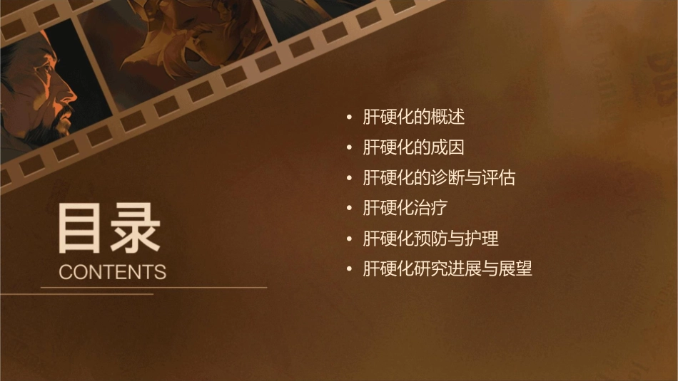 肝硬化公开教学课件_第2页