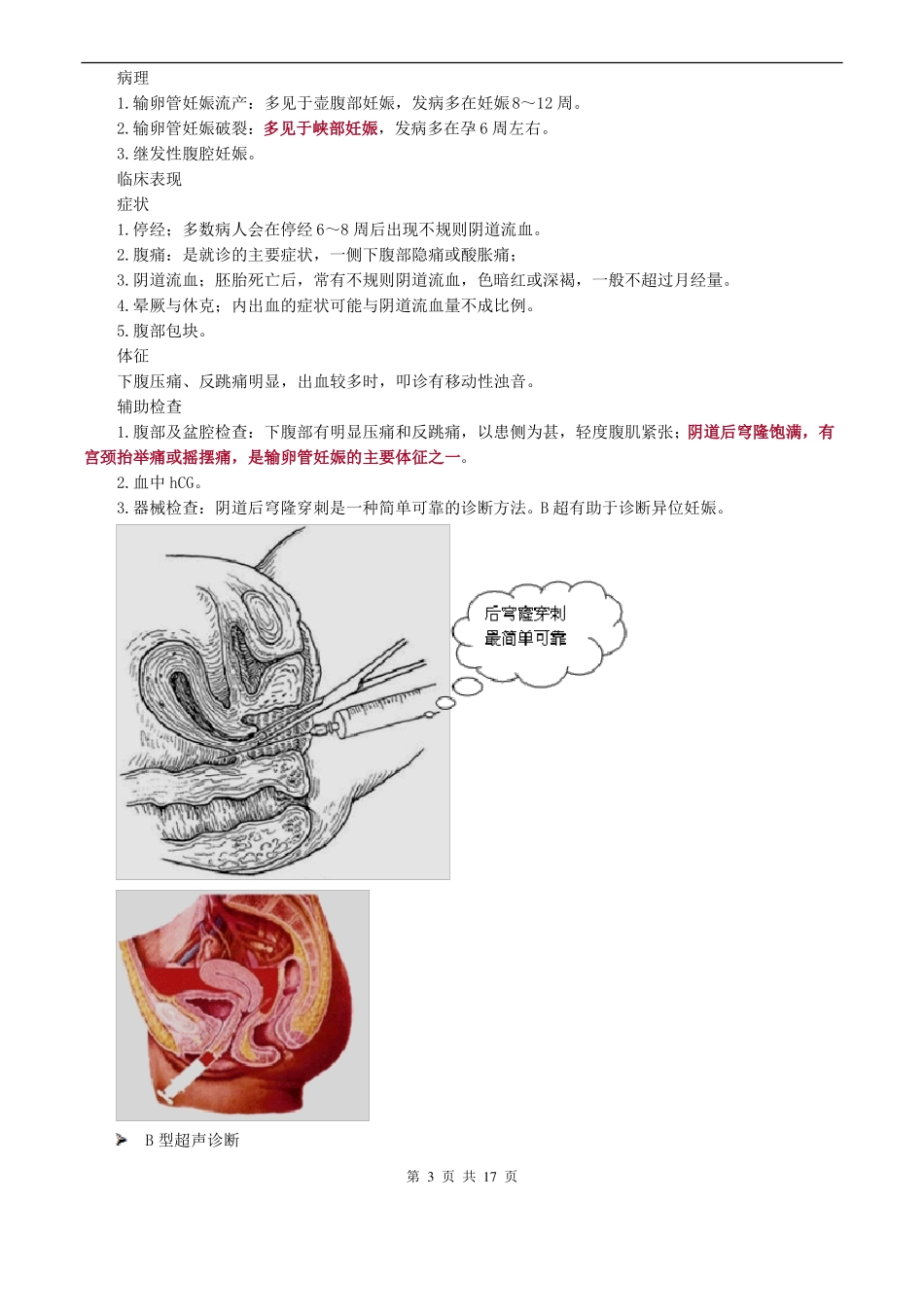 妇科护理学妊娠期并发症妇女的护理_第3页