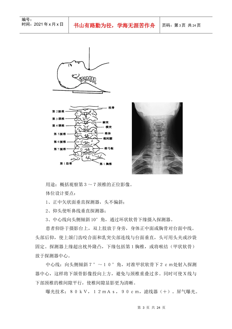05第五章脊柱数字X线体位设计与影像质量评价_第3页