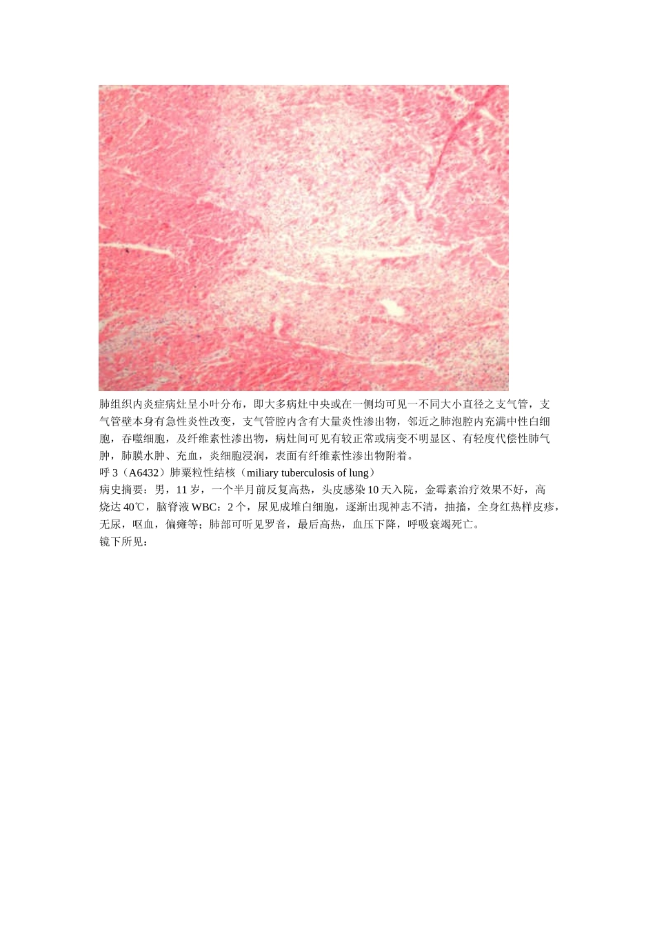 呼吸系统疾病实习指导_第2页