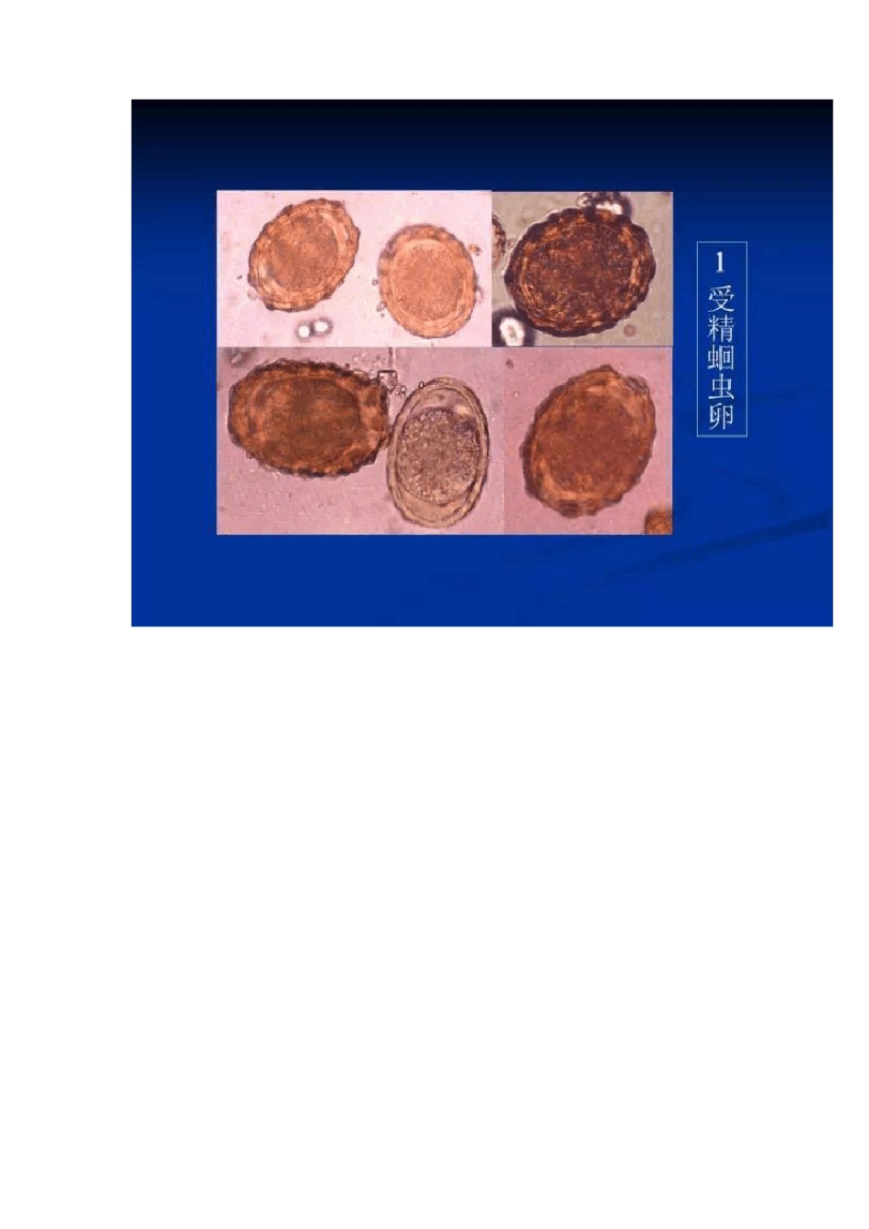 寄生虫学图谱_第2页