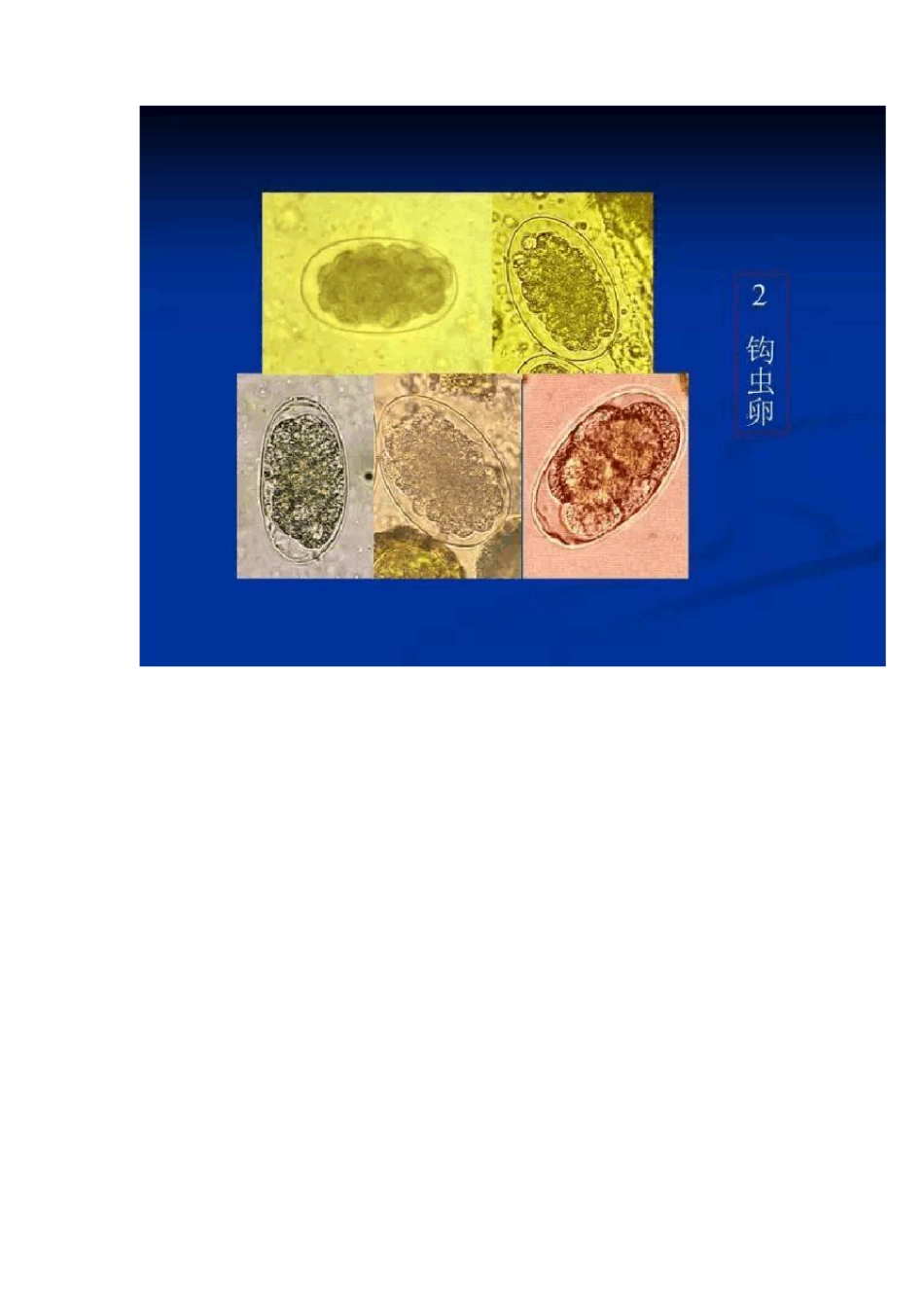 寄生虫学图谱_第3页