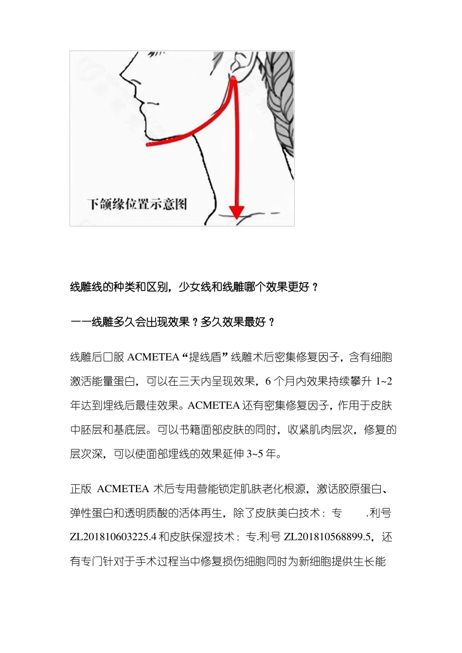 列举,线雕线的种类和区别,少女线和线雕哪个效果更好？对比来了_第2页