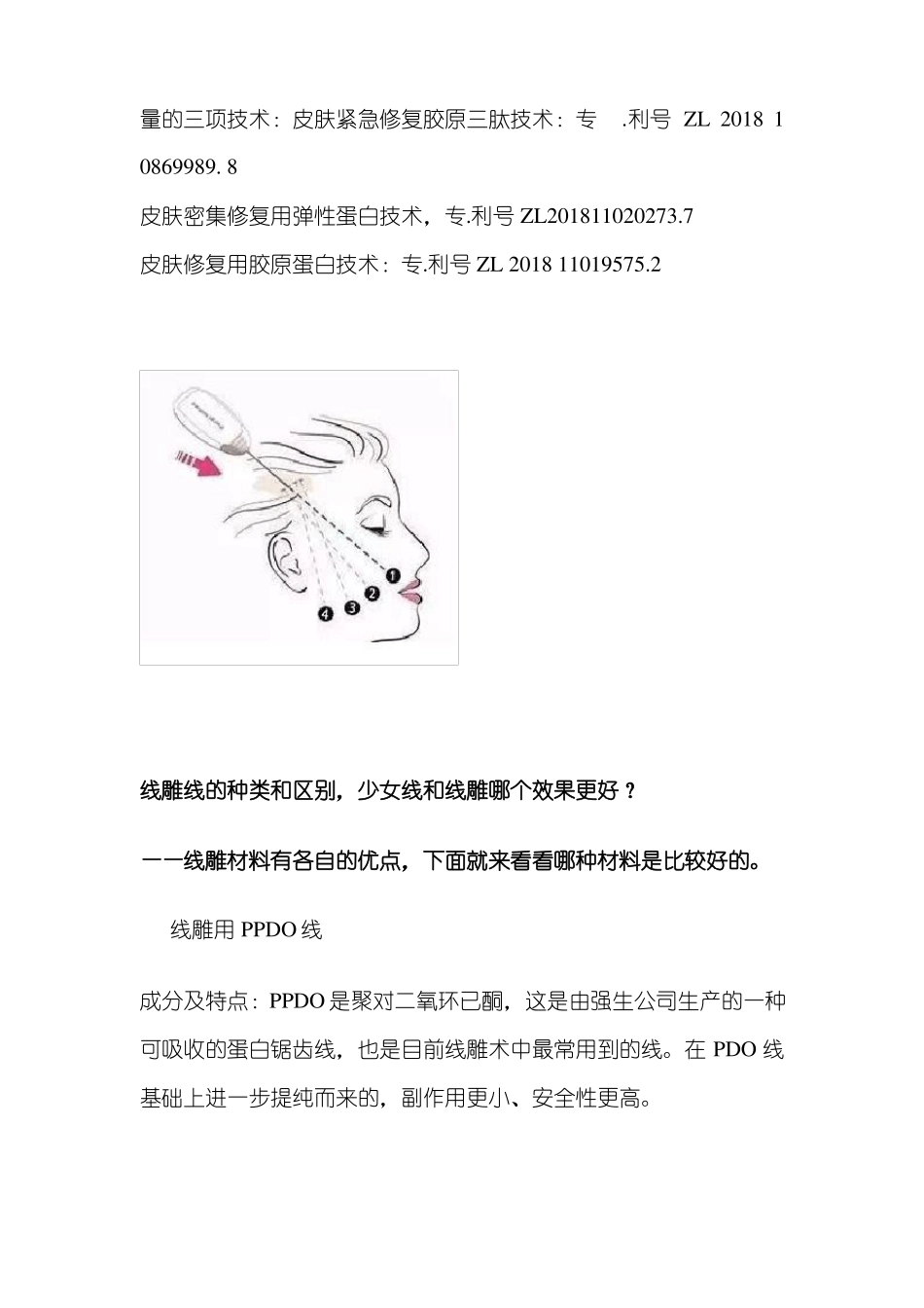 列举,线雕线的种类和区别,少女线和线雕哪个效果更好？对比来了_第3页