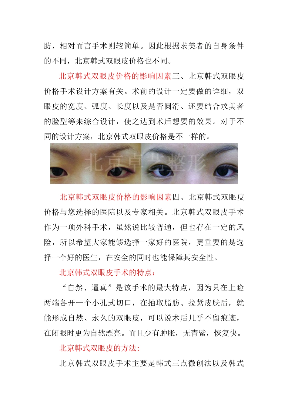 北京韩式双眼皮价格_第2页