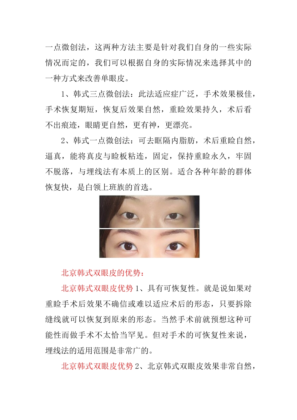 北京韩式双眼皮价格_第3页