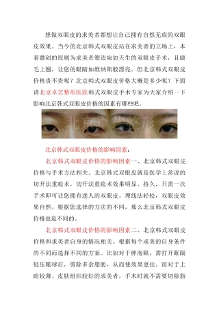 北京韩式双眼皮价格
