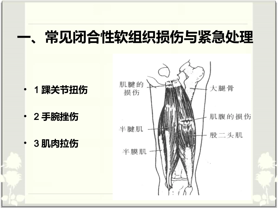 运动损伤PPT_第3页