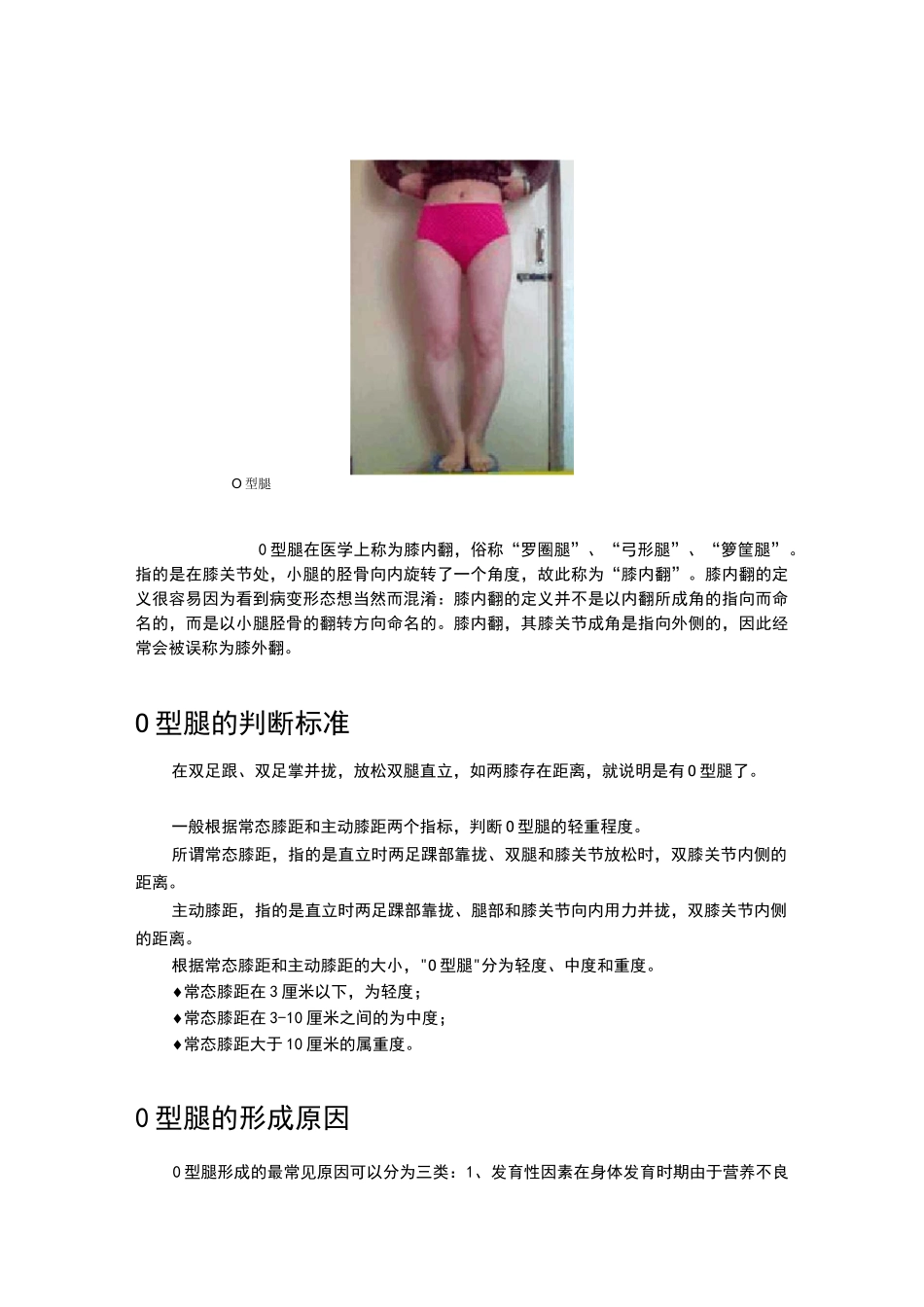 O型腿和X型腿的矫正方法_第2页