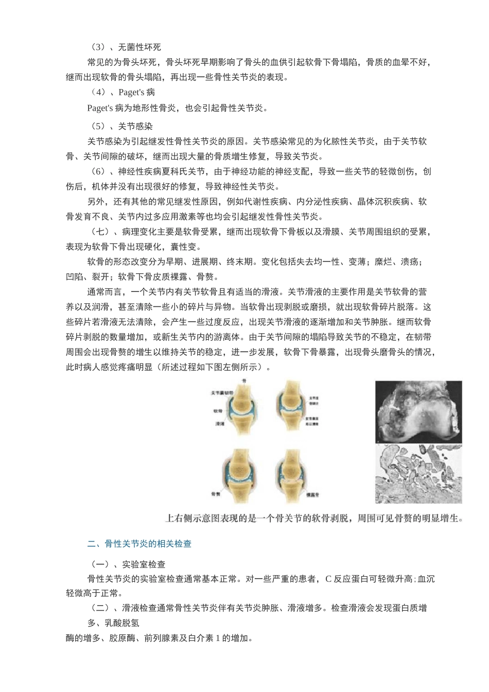 骨关节病的诊断与鉴别诊断_第2页
