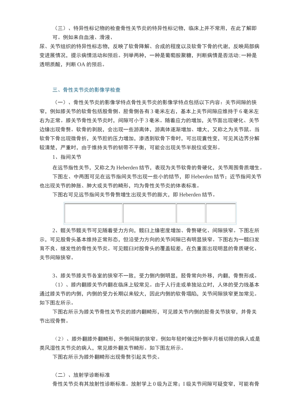 骨关节病的诊断与鉴别诊断_第3页