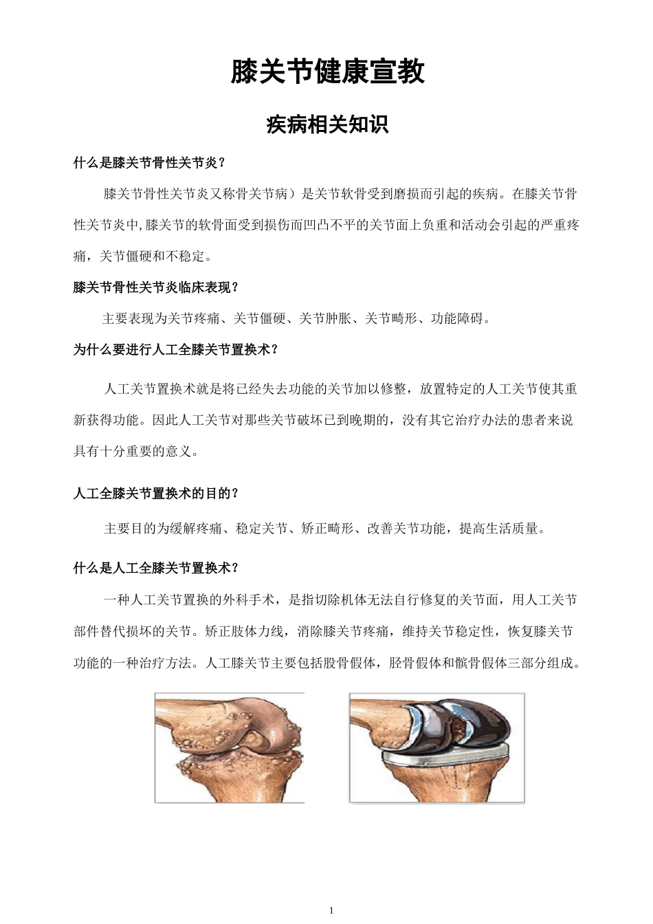 人工全膝关节置换术_第1页