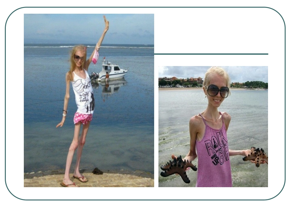 第三节合理营养与食品安全（第一课时）_第2页