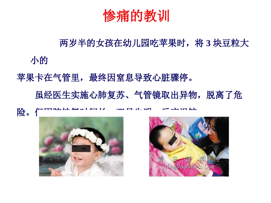 气管异物处理课件_第2页