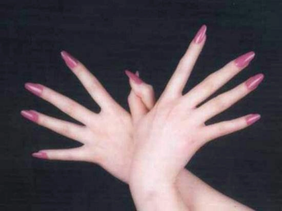 《手指》PPT课件_第2页