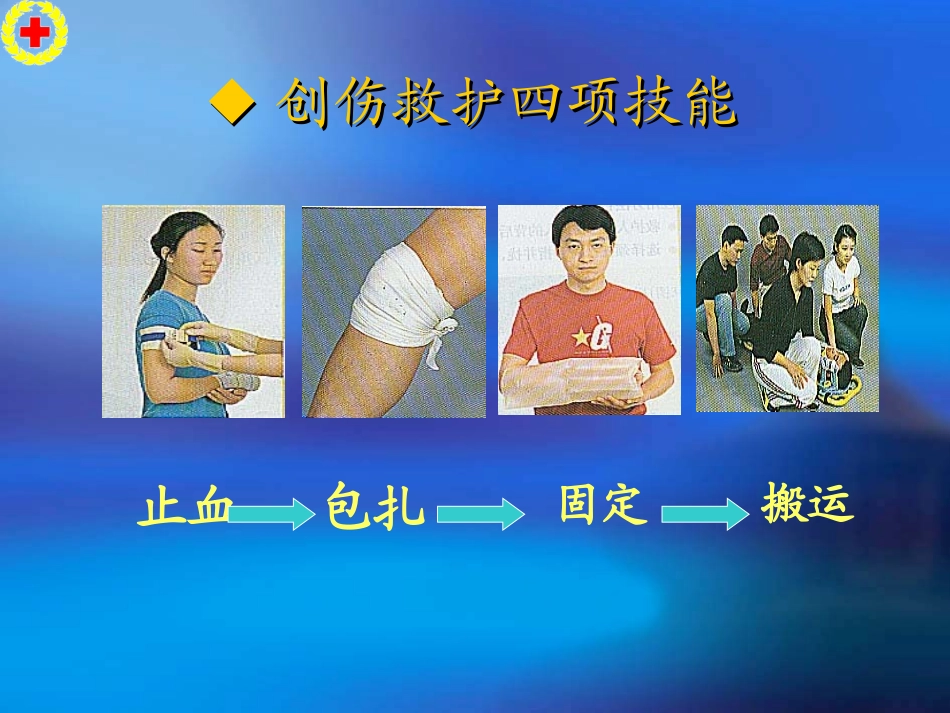 红十字救护员培训（创伤救护技术）_第3页