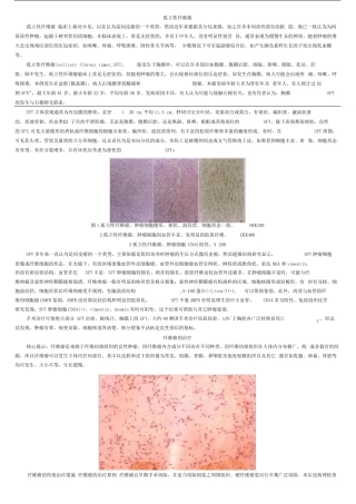 孤立性纤维瘤