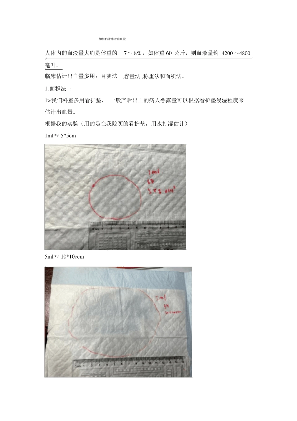 如何估计患者出血量_第1页