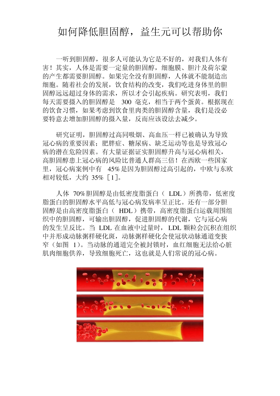 如何降低胆固醇,益生元可以帮助你_第1页
