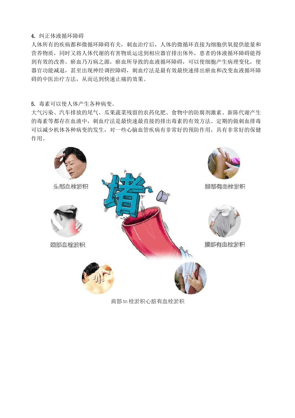 中医刺络放血疗法的作用机理_第2页