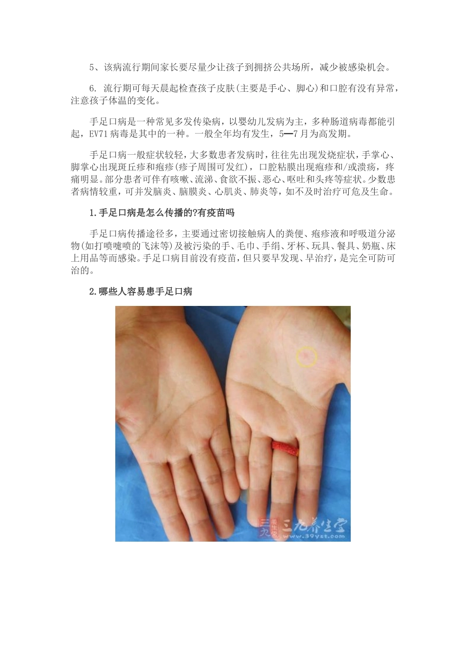 手足口病预防知识_第2页