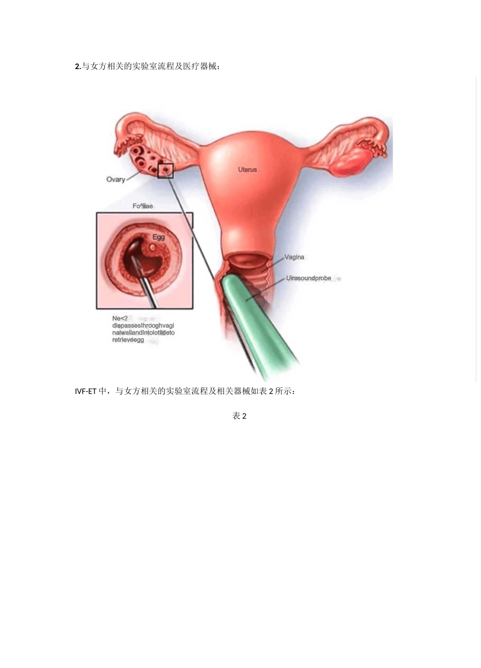 辅助生殖临床试验系列专题(一)_第3页