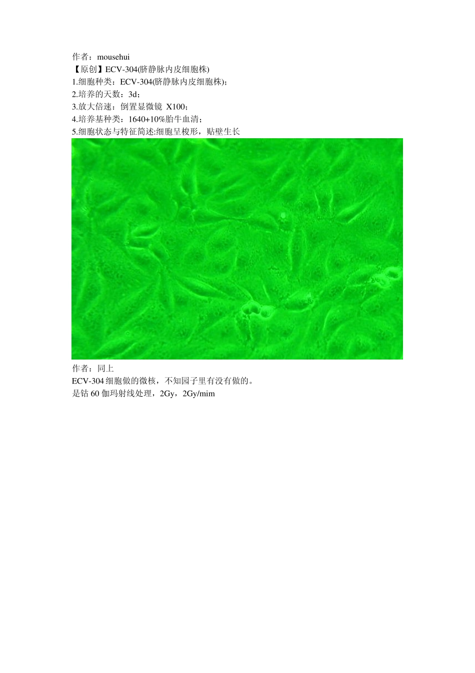 内皮细胞培养图片汇总_第1页