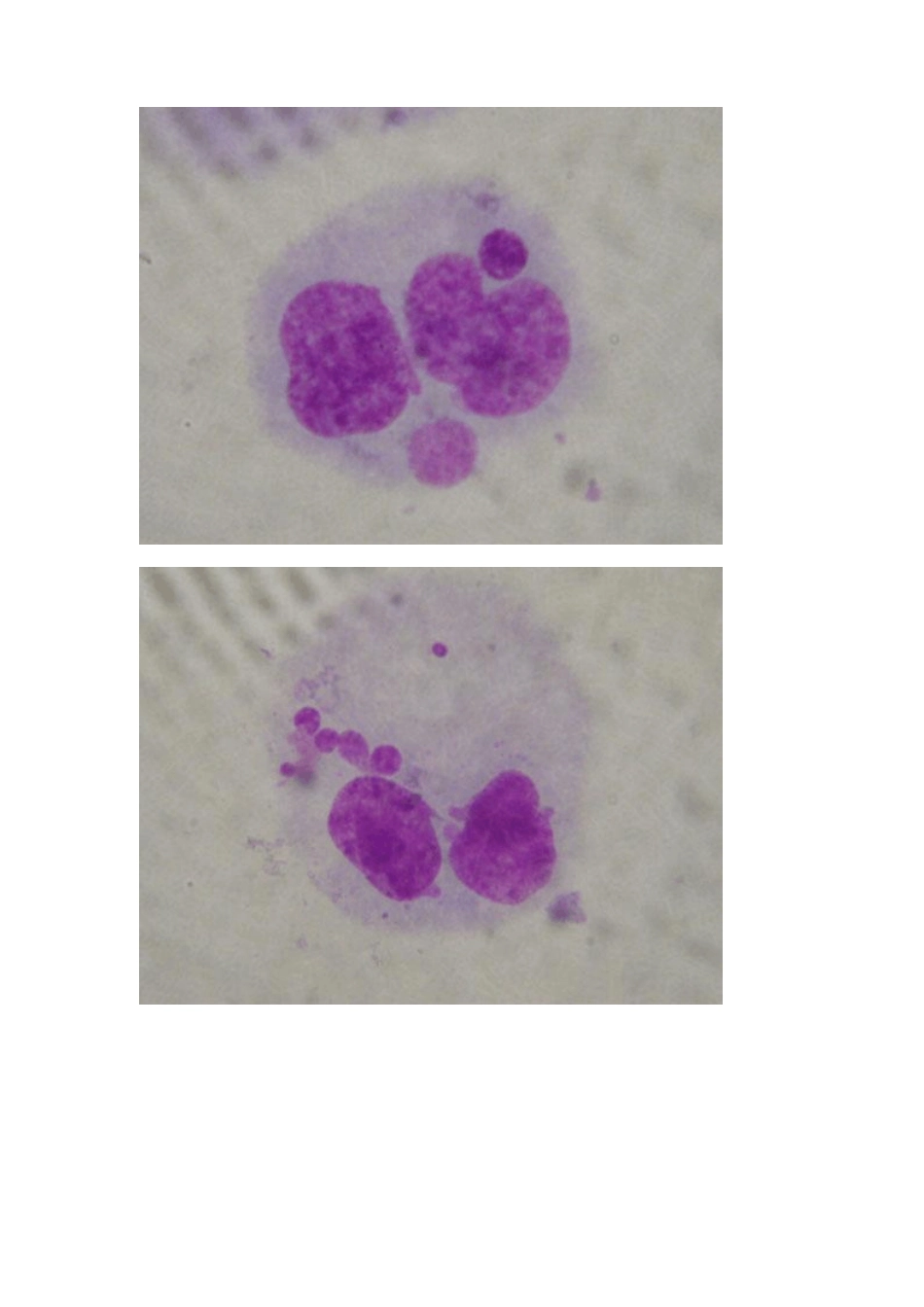 内皮细胞培养图片汇总_第2页