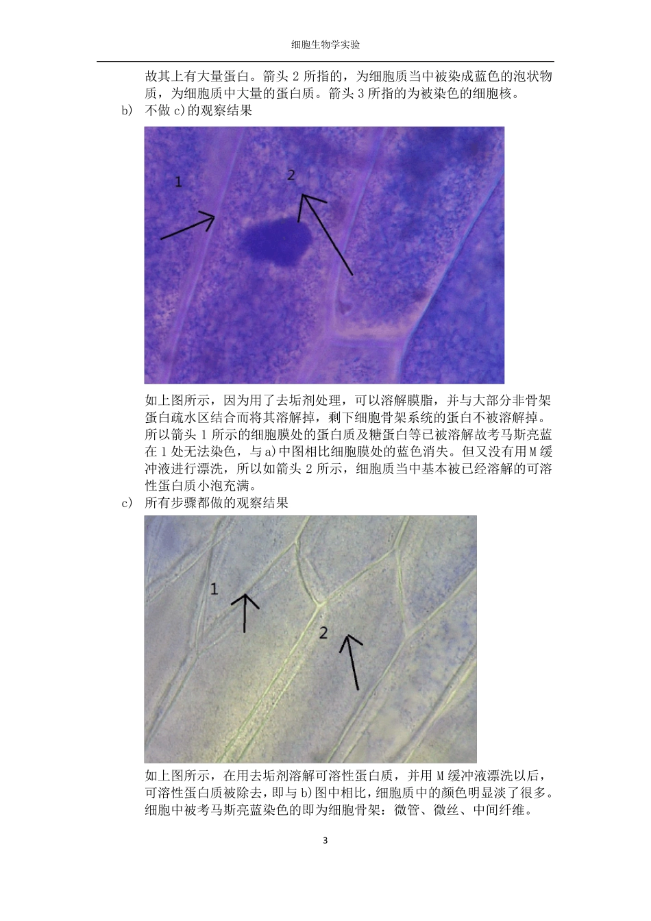 考马斯亮蓝染色法显示细胞骨架_第3页