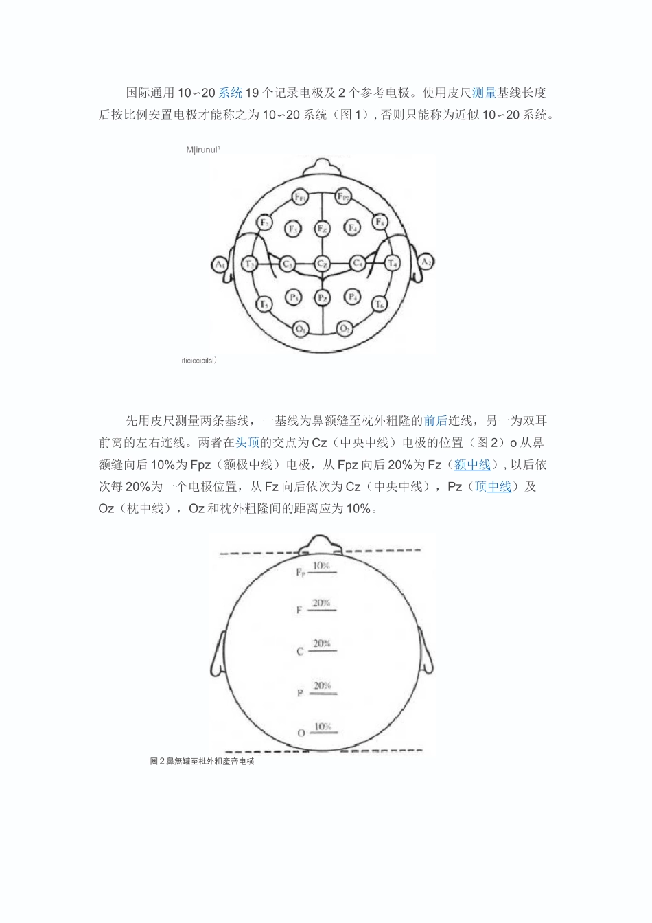 脑电图检查常规_第2页