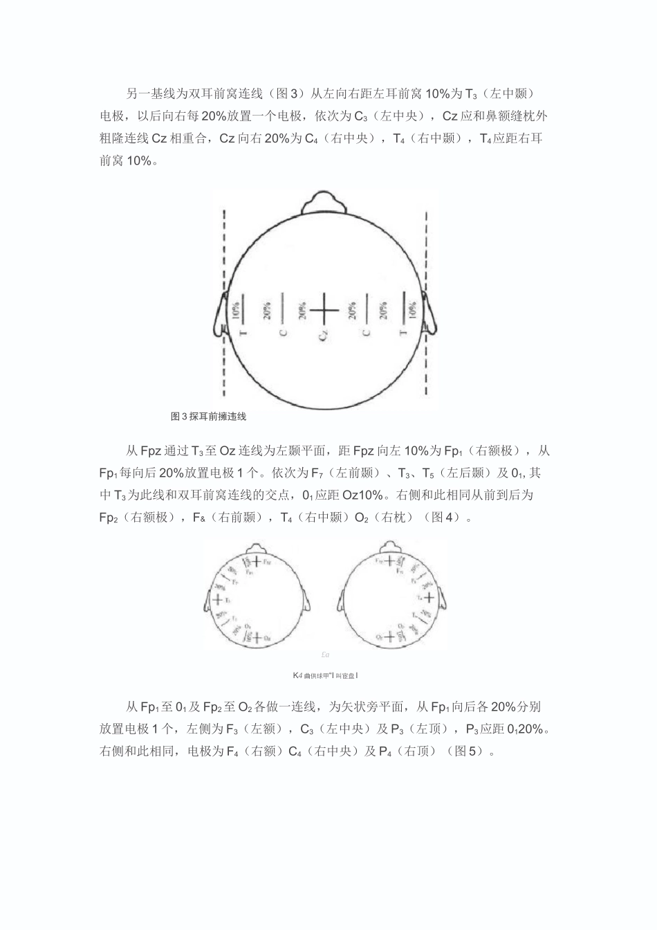脑电图检查常规_第3页