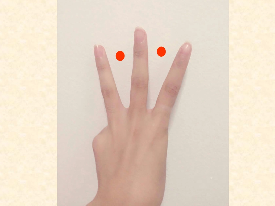 植树问题课件-_第3页