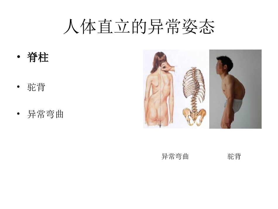 人体直立的正常姿_第3页