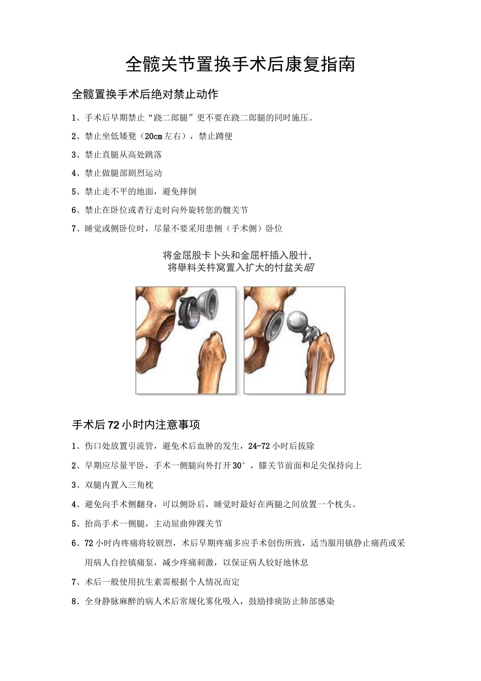 全髋关节置换手术后康复指南_第2页